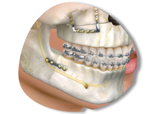dentaisa oral