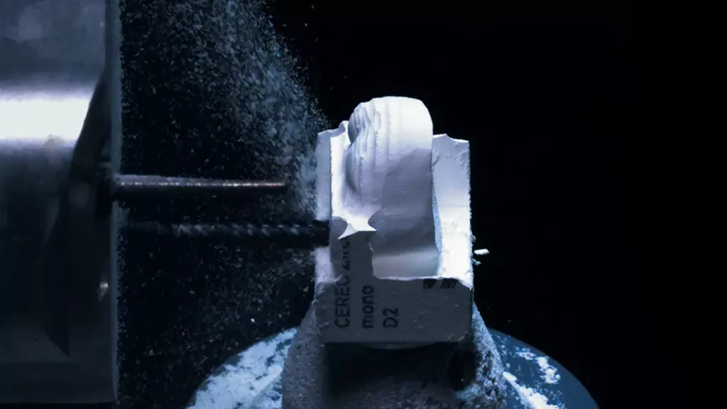 Best Dental Inlays & Onlays